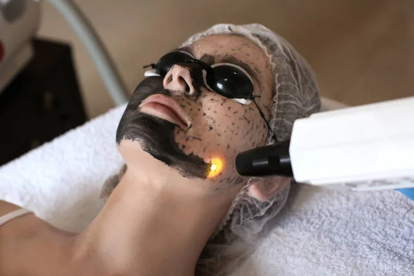Tout savoir sur le Carbon Peel, en exclusivité à Cannes