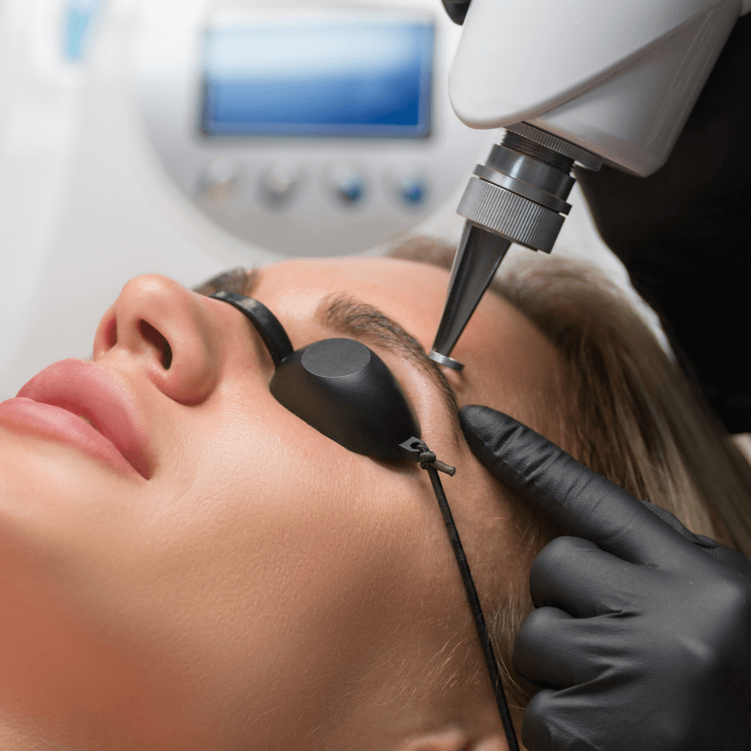 Détatouage Cannes - Méthodes douces et efficaces